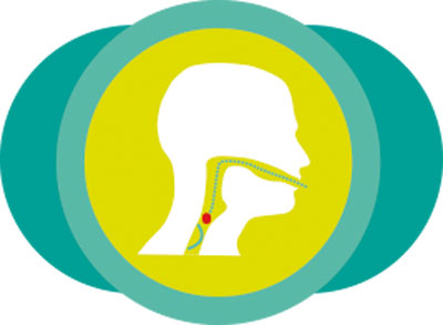 dysphagia-swallowing-picture